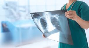 The Essential Role of Rad Tech in Modern Healthcare